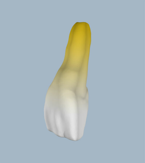 1121-04-ICMX - Incisive centrale maxillaire (vue 2D) - RightNao