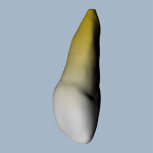 1121-01-02-03-05-06-ICMX - Incisive centrale maxillaire (vue 2D) - RightNao