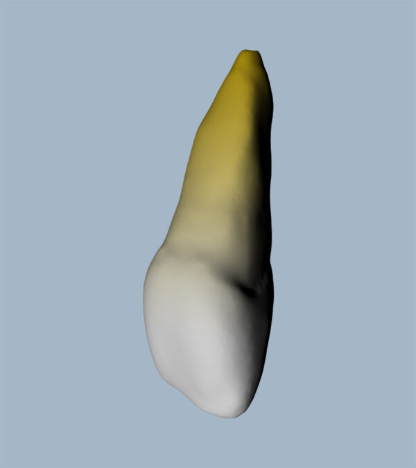 1121-01-02-03-05-06-ICMX - Incisive centrale maxillaire (vue 2D) - RightNao