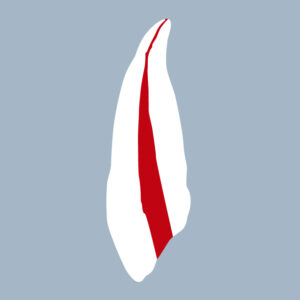 1323-01-o-CMX-Canine maxillaire avec cavité d'accès (coupe) - RightNao