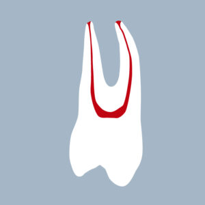 1424-03-1PMX - Première prémolaire maxillaire - RightNao