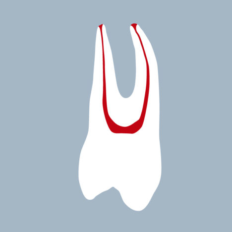 1424-03-1PMX - Première prémolaire maxillaire - RightNao