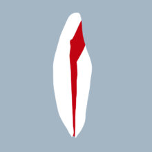 3132-4142-01-o - Incisive mandibulaire avec cavité d’accès réalisée (coupe) 3132-4142-01-o - Incisive mandibulaire avec cavité d’accès réalisée (coupe) - RightNao