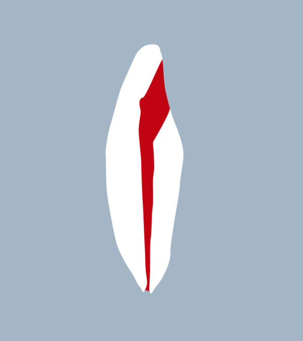 3132-4142-01-o - Incisive mandibulaire avec cavité d’accès réalisée (coupe) - RightNao