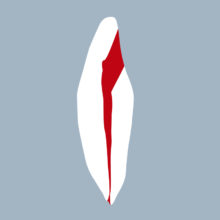 3132-4142-02-o - Incisive mandibulaire avec cavité d’accès réalisée (coupe) - RightNao