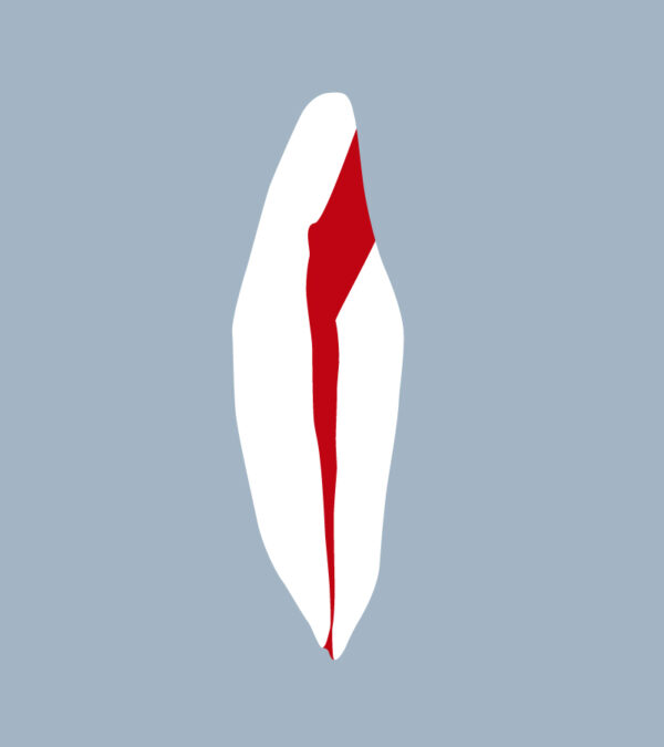3132-4142-02-o - Incisive mandibulaire avec cavité d’accès réalisée (coupe) - RightNao