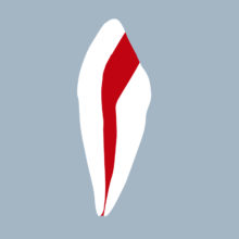 3343-01-o - Canine mandibulaire avec cavité d’accès réalisée (coupe) 3343-01-o - Canine mandibulaire avec cavité d’accès réalisée (coupe) - RightNao