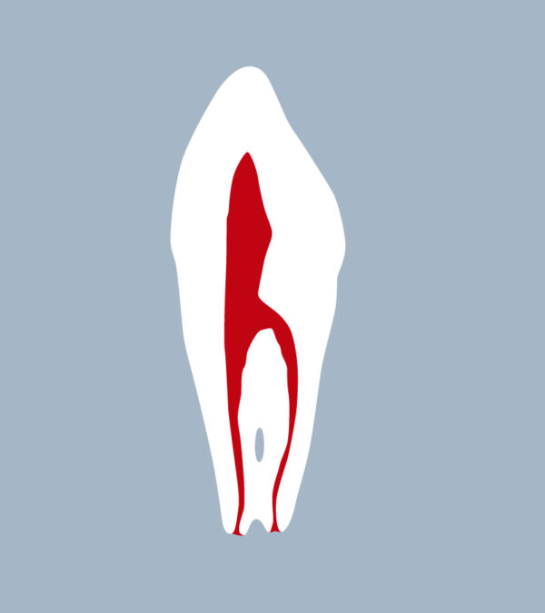 3343-02-CMB - Canine mandibulaire (coupe) - RightNao
