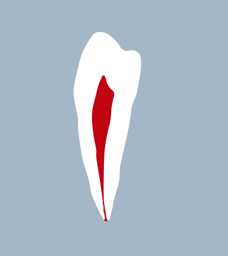 3444-01-1PMB - Première prémolaire mandibulaire (coupe) - RightNao