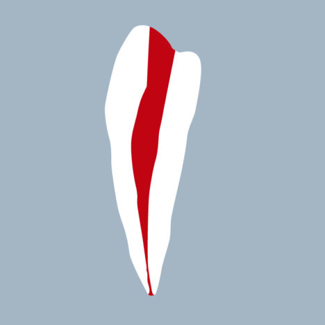 3444-01-o - Première prémolaire mandibulaire avec cavité d’accès réalisée (coupe) - RightNao