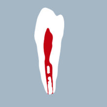 3444-02-1PMB - Première prémolaire mandibulaire (coupe) - RightNao