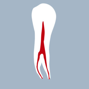 3444-03-1PMB - Première prémolaire mandibulaire (coupe) - RightNao