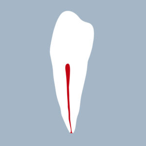 3444-04-1PMB - Première prémolaire mandibulaire (coupe) - RightNao