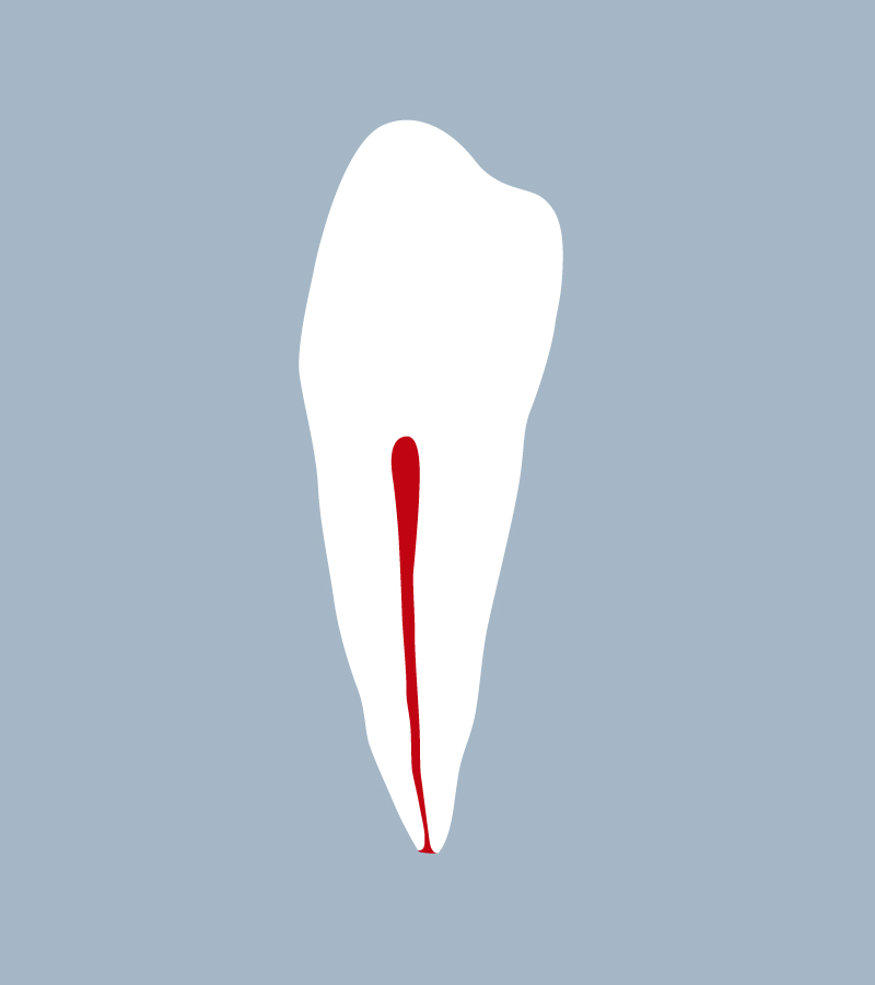 3444-04-1PMB - Première prémolaire mandibulaire (coupe) - RightNao