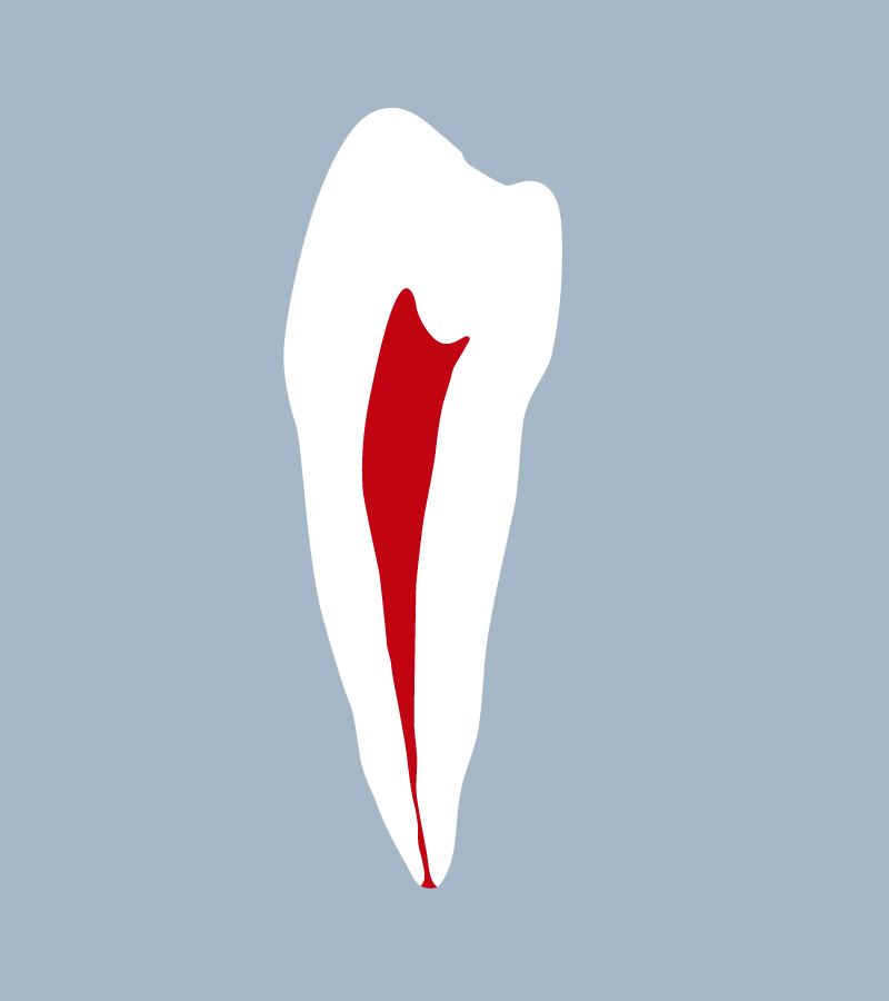 3545-01-2PMB - Seconde prémolaire mandibulaire (coupe) - RightNao