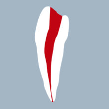 3545-01-o - Seconde prémolaire mandibulaire avec cavité d’accès réalisée (coupe) 3545-01-o - Seconde prémolaire mandibulaire avec cavité d’accès réalisée (coupe) - RightNao