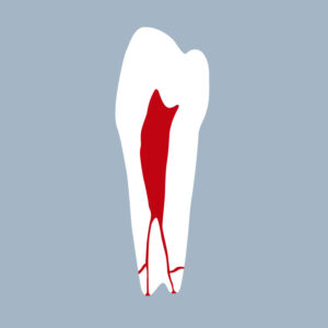 3545-02-2PMB - Seconde prémolaire mandibulaire (coupe) - NaodetntEvolution