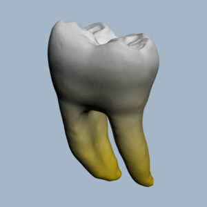 3646-01-02-03-1MMB - Première molaire mandibulaire (vue 2D) - RightNao