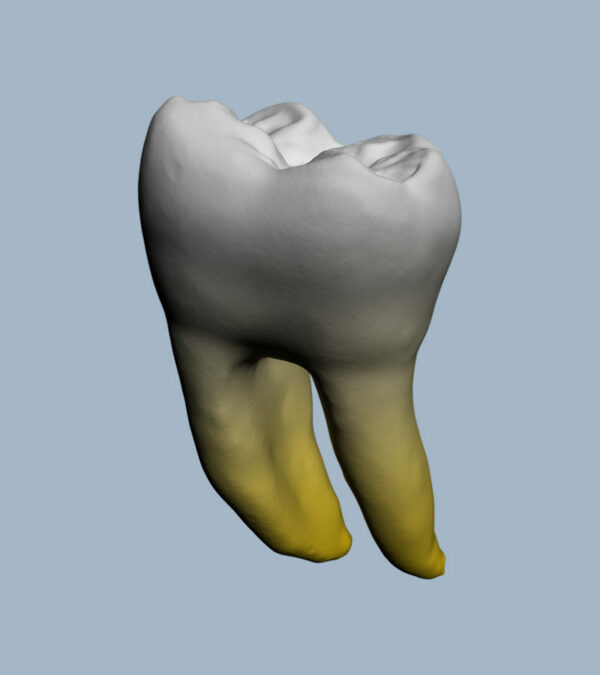 3646-01-02-03-1MMB - Première molaire mandibulaire (vue 2D) - RightNao