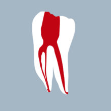 3646-02-o-1MMB - Première molaire mandibulaire (coupe) - RightNao