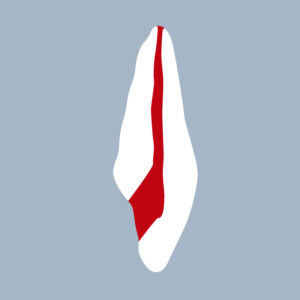 1121-02-o-ICMX-Incisive centrale maxillaire avec cavité d’accès réalisée (coupe) - RightNao