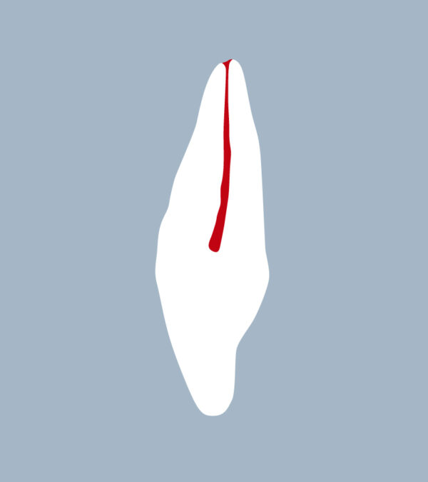 1222-02-ILMX - الفك العلوي الجانبي (قطع) - RightNao