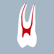 1424-01-1PMX - Première prémolaire maxillaire (coupe) 1424-01-1PMX - Première prémolaire maxillaire (coupe) - RightNao