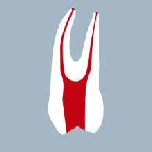 1424-01-o-1PMX - Première prémolaire maxillaire avec cavité d’accès réalisée (coupe) - RightNao