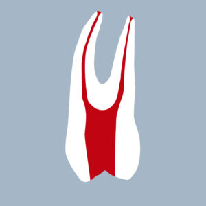 1424-01-o-1PMX - Première prémolaire maxillaire avec cavité d’accès réalisée (coupe) - RightNao