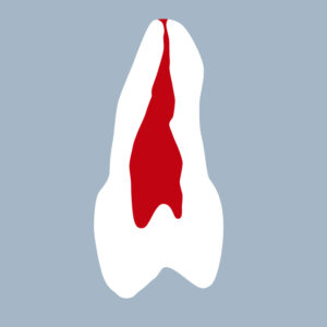 1525-01-2PMX - Seconde prémolaire maxillaire (coupe) - RightNao