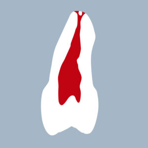 1525-02-2PMX - Seconde prémolaire maxillaire (coupe) - RightNao