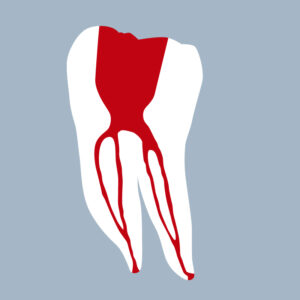 3646-01-o-1MMB - Première molaire mandibulaire (coupe) - RightNao