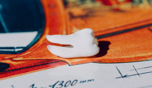 Molaire mandibulaire - RightNao - Copyright Jean-Baptiste Roger