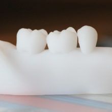 Nouveautés 2020 - Bloc Endo-Resto - Couronne, détail 1 - Copyright Jean-Baptiste Roger - RightNao