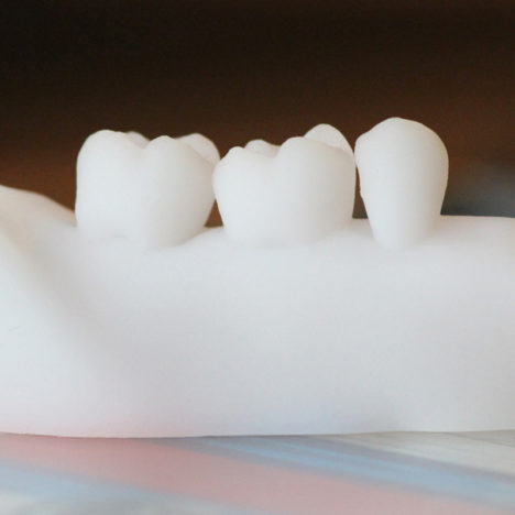 Nouveautés 2020 - Bloc Endo-Resto - Couronne, détail 1 - Copyright Jean-Baptiste Roger - RightNao