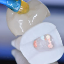 Nouveautés 2020 - Bloc Endo-Resto - Couronne, détail 3 - Copyright RightNao