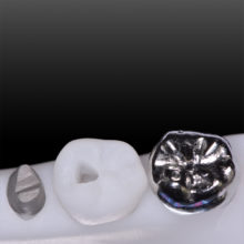 Nouveautés 2020 - Kit Endo Prothèse complet, vue 2 - Copyright RightNao