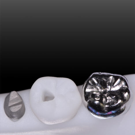 Nouveautés 2020 - Kit Endo Prothèse complet, vue 2 - Copyright RightNao