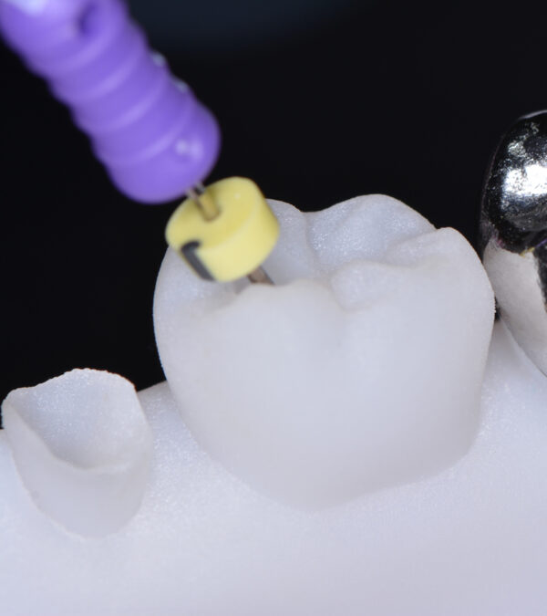 Nouveautés 2020 - Kit Endo Prothèse sans Inlay Core - Copyright RightNao