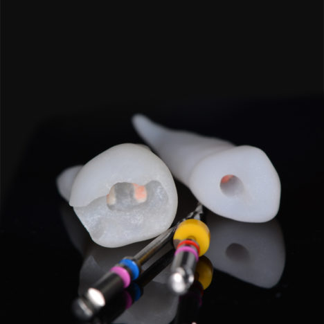 Nouveautés 2020 - Retraitement canalaire - Molaire, canine et outils - Copyright RightNao