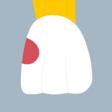 21-M - Dent cariée - Incisive centrale supérieure gauche, tracés - Copyright RightNao