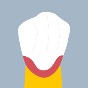 33-C - Dent cariée - Canine inférieure gauche, tracés - Copyright RightNao