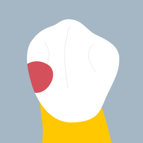 34-M - Dent cariée - Premiere prémolaire inférieure gauche, tracés - Copyright RightNao