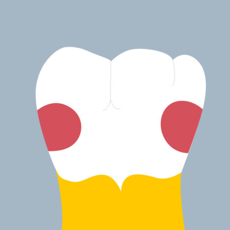 36-MD - Dent cariée - Premiere molaire inférieure gauche, tracés - Copyright RightNao