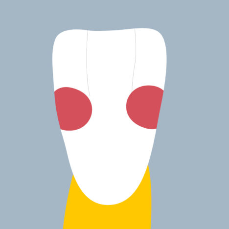 41-MD - Dent cariée - Incisive centrale inférieure droite, tracés - Copyright RightNao