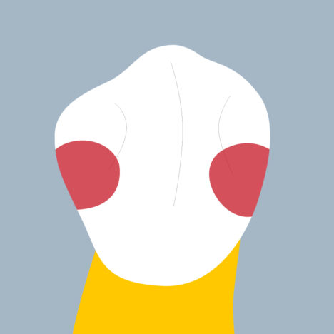 45-MD - Dent cariée - Seconde premolaire inférieure droite, tracés - Copyright RightNao