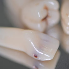 DCA - Visuel dents cariées, détail incisive - Copyright RightNao