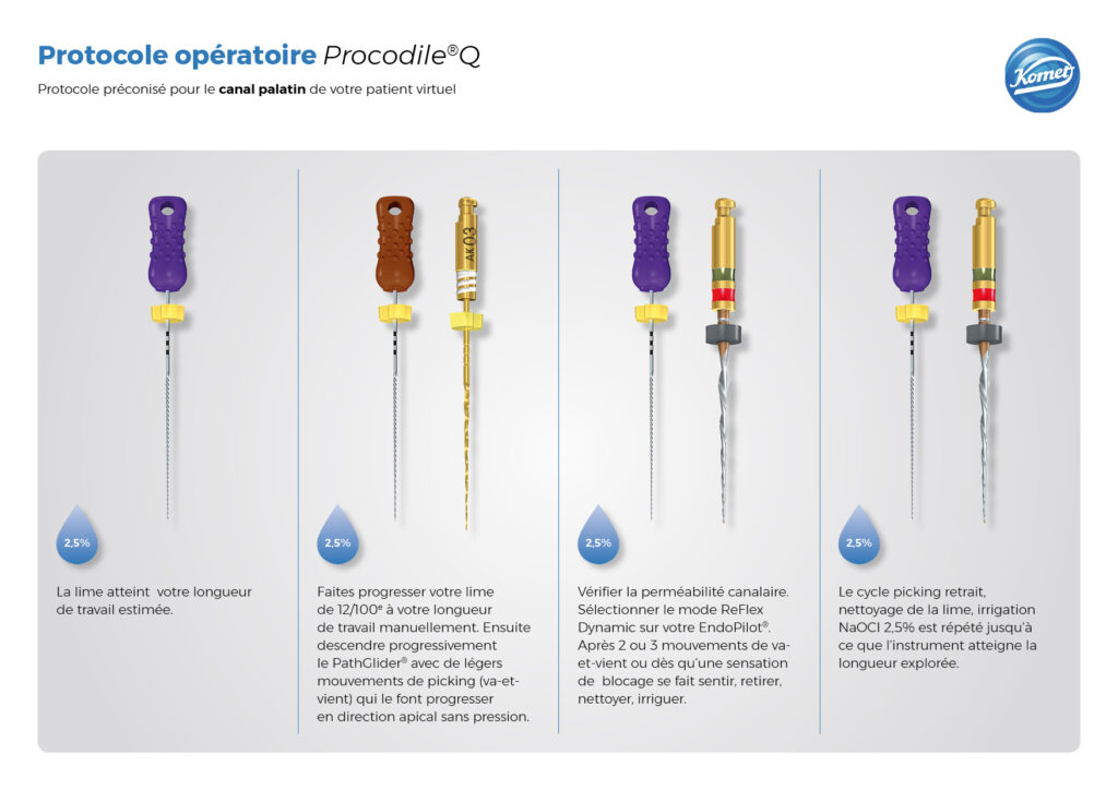 Visual of the &quot;Palatal canal operating protocol 14/24 - Komet France&quot; - Copyright RightNao